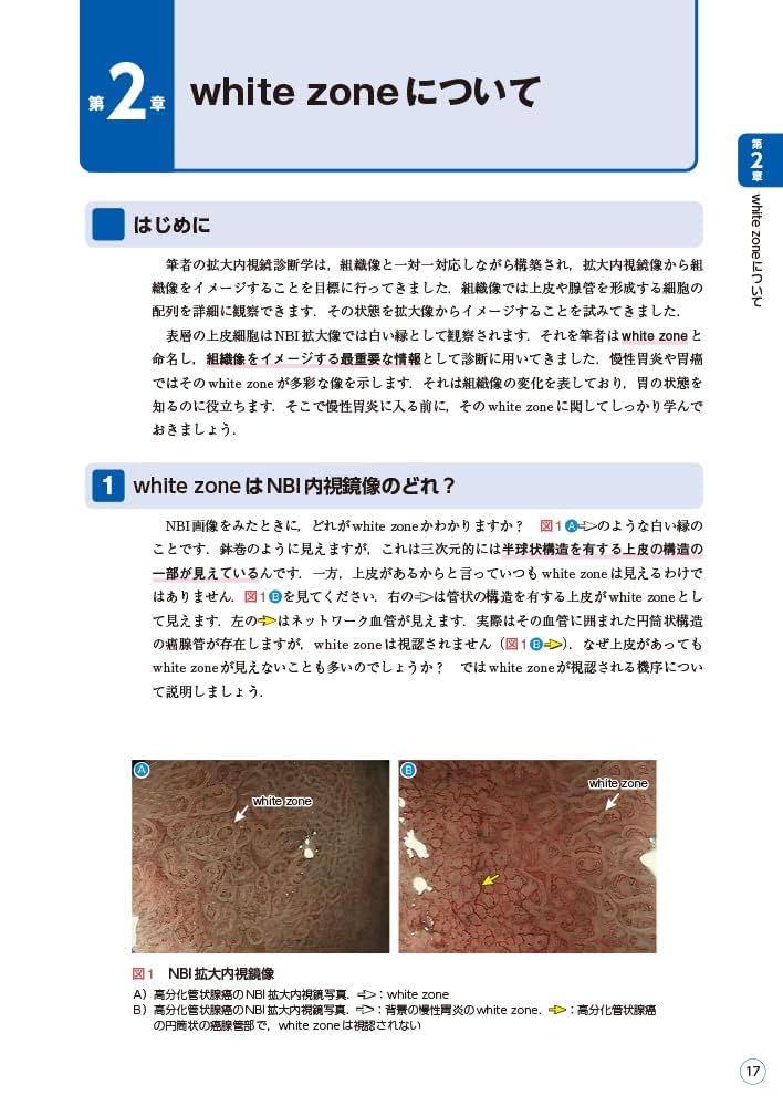 早期肺癌 内視鏡所見を中心に/金原出版/加藤治文（単行本） 早期肺癌 内視鏡所見を中心に/金原出版/加藤治文（単行本）